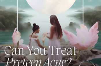 CAN YOU TREAT PUBERTY ACNE? 4 REASONS TO START YOUR PRETEEN’S TREATMENT SOONER
